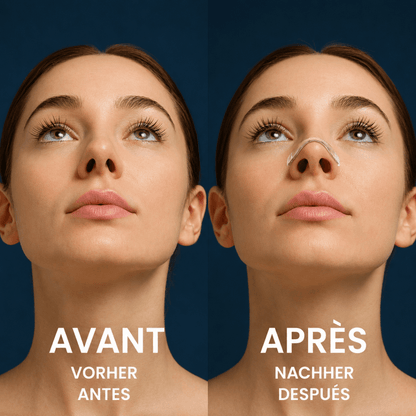 Avant après utilisation du patch nasal Respira pour améliorer la respiration nasale